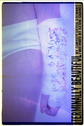 Terminally Beautiful Kindle Edition